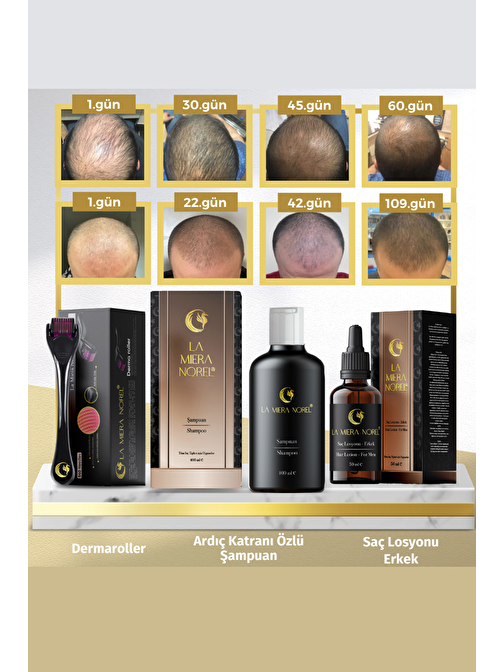 Kampanyalı Başlangıç Paketi - Erkek Ardıç Katranlı Saç Bakım Losyonu - Dökülme Önleyici Şampuan - Dermaroller