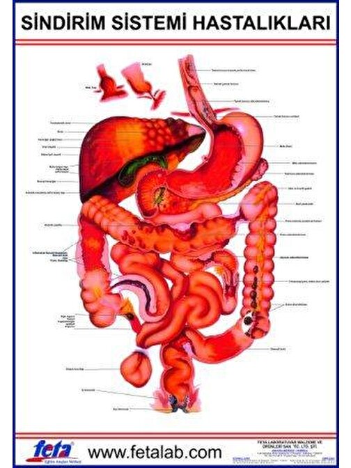 Edulab Sindirim Sistemi Hastalıkları Eğitim Plakası
