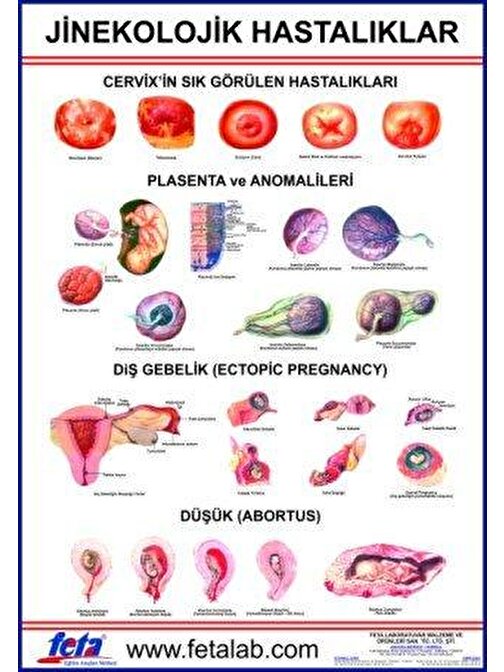 Jinekolojik Hastalıklar Eğitim Plakası