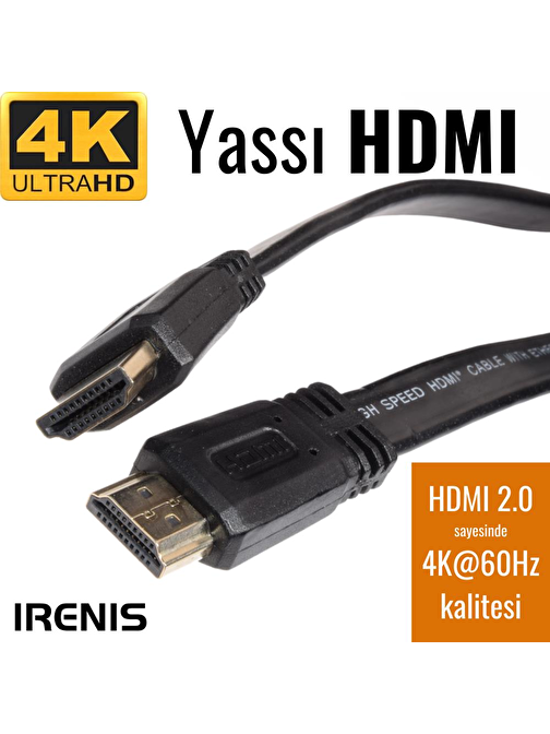 IRENIS HDMI Kablo - Yassı 4K HDMI Kablosu (4K 60Hz, HDMI 2.0)